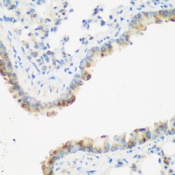 Insulin Like Growth Factor 2 mRNA Binding Protein 3 (IGF2BP3) Antibody