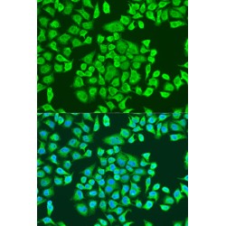 Insulin Like Growth Factor 2 mRNA Binding Protein 3 (IGF2BP3) Antibody