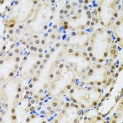 Immunohistochemistry of paraffin-embedded Rat kidney using POP4 Antibody (1/100 dilution, 40x lens).
