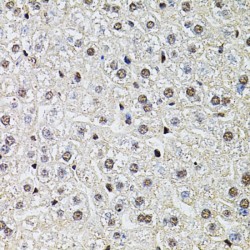 POP4 Homolog, Ribonuclease P/MRP Subunit (POP4) Antibody
