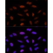 abx003409