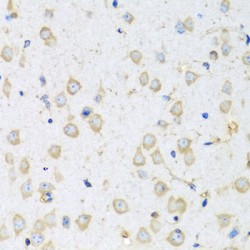 Coactosin-Like Protein (COTL1) Antibody
