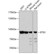 Western blot analysis of extracts of various cell lines using IFT81 Antibody (1/3000 dilution).