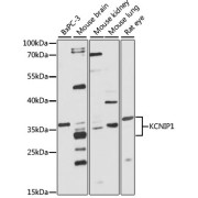 abx003535