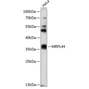 Western blot analysis of extracts of HeLa cells using MRPL44 Antibody (1/2000 dilution).