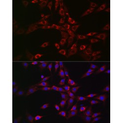 Charged Multivesicular Body Protein 6 (CHMP6) Antibody