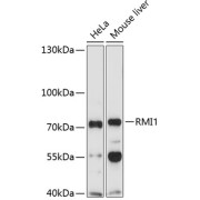 Western blot analysis of extracts of various cell lines using RMI1 Antibody (1/1000 dilution).