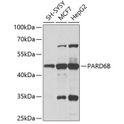 abx003865
