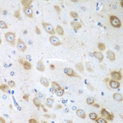 G-Elongation Factor, Mitochondrial 1 (GFM1) Antibody