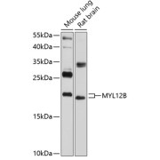 Western blot analysis of extracts of various cell lines using MYL12B Antibody (1/1000 dilution).