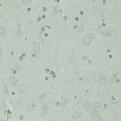 General Transcription Factor IIH, Polypeptide 2-Like Protein (GTF2H2C) Antibody