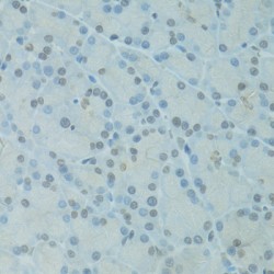 General Transcription Factor IIH, Polypeptide 2-Like Protein (GTF2H2C) Antibody