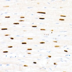 Forkhead Box Protein P1 (FOXP1) Antibody