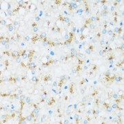 Immunohistochemistry of paraffin-embedded Human liver using APOD Antibody (1/100 dilution, 40x lens).
