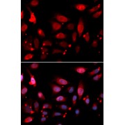 Immunofluorescence analysis of U2OS cells using RACGAP1 Antibody