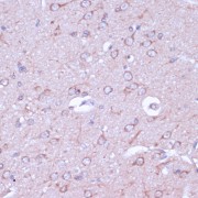 Immunohistochemistry of paraffin-embedded Rat brain using PRKACB Antibody (1/100 dilution, 40x lens).