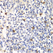 Immunohistochemistry of paraffin-embedded Mouse spleen using PSMD7 Antibody (1/100 dilution, 40x lens).
