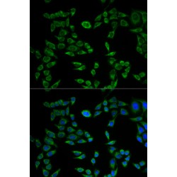 Vesicle-Associated Membrane Protein-Associated Protein B/C (VAPB) Antibody