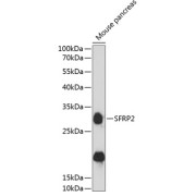 Western blot analysis of extracts of mouse pancreas using SFRP2 Antibody (1/3000 dilution).