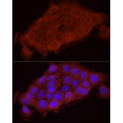 Secreted Frizzled Related Protein 2 (SFRP2) Antibody