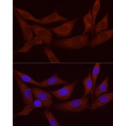 Secreted Frizzled Related Protein 2 (SFRP2) Antibody