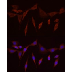 Secreted Frizzled Related Protein 2 (SFRP2) Antibody