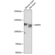 Western blot analysis of extracts of various cell lines using AMPH Antibody (1/1000 dilution).