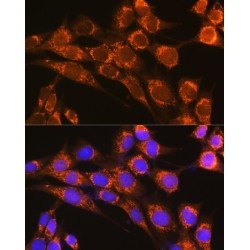 Properdin (CFP) Antibody