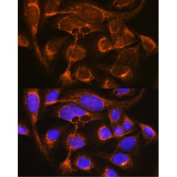 Properdin (CFP) Antibody