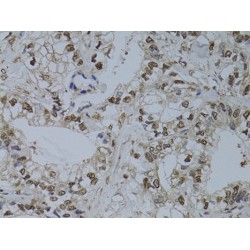 Checkpoint Protein HUS1 (HUS1) Antibody