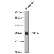 Western blot analysis of extracts of Mouse liver using PRKRA Antibody (1/1000 dilution).
