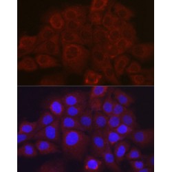 Serpin B3 (SERPINB3) Antibody