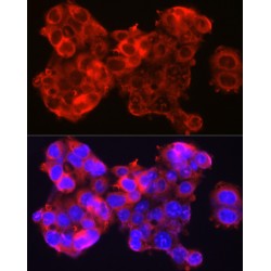Serpin B3 (SERPINB3) Antibody