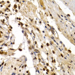 Transcription Factor Dp-1 (TFDP1) Antibody