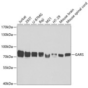 Western blot analysis of extracts of various cell lines using GARS Antibody (1/50 dilution)00.