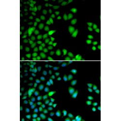 Ribosomal Protein S6 Kinase A3 (RPS6KA3) Antibody