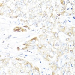 Hydroxysteroid 17-Beta Dehydrogenase 10 (HSD17B10) Antibody