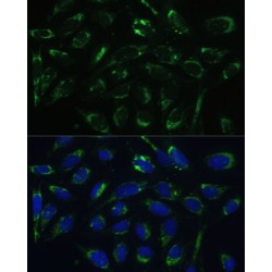 Hydroxysteroid 17-Beta Dehydrogenase 10 (HSD17B10) Antibody