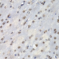 Proteasome Subunit Beta Type 10 (PSMB10) Antibody