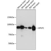 Western blot analysis of extracts of various cell lines using APLP2 Antibody (1/1000 dilution).