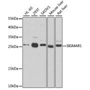 Western blot analysis of extracts of various cell lines using SIGMAR1 Antibody (1/50 dilution)0.