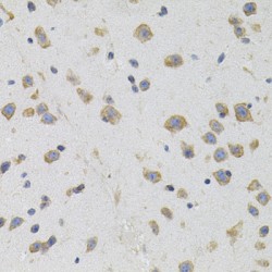 sigma R1 Antibody