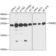 Western blot analysis of extracts of various cell lines using PSMB2 Antibody (1/1000 dilution).