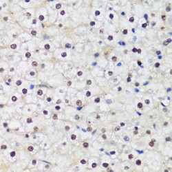 DNA Methyltransferase 1 (Dnmt1) Antibody
