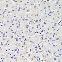 DNA Methyltransferase 1 (Dnmt1) Antibody