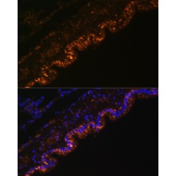 Amiloride Sensitive Sodium Channel Subunit Alpha (SCNN1A) Antibody