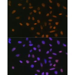 Snail Family Transcriptional Repressor 1 / SNAIL (SNAI1) Antibody