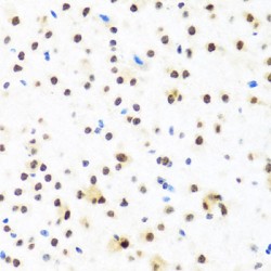 Far Upstream Element (FUSE) Binding Protein 1 (FUBP1) Antibody