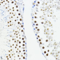 Zinc Finger E-Box-Binding Homeobox 1 (ZEB1) Antibody