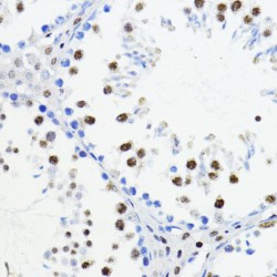 Zinc Finger E-Box-Binding Homeobox 1 (ZEB1) Antibody